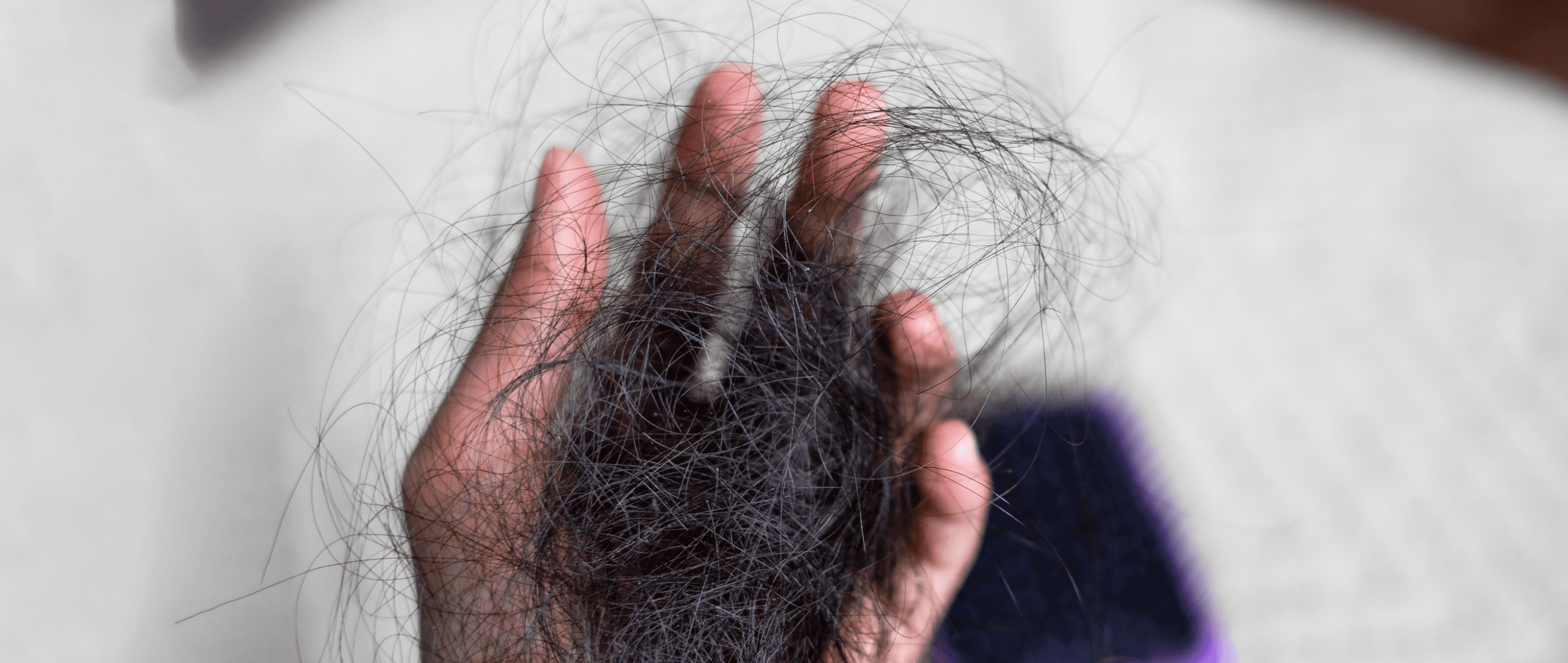 Stop Hair Loss Now: Your Top Defence for a Thriving Mane