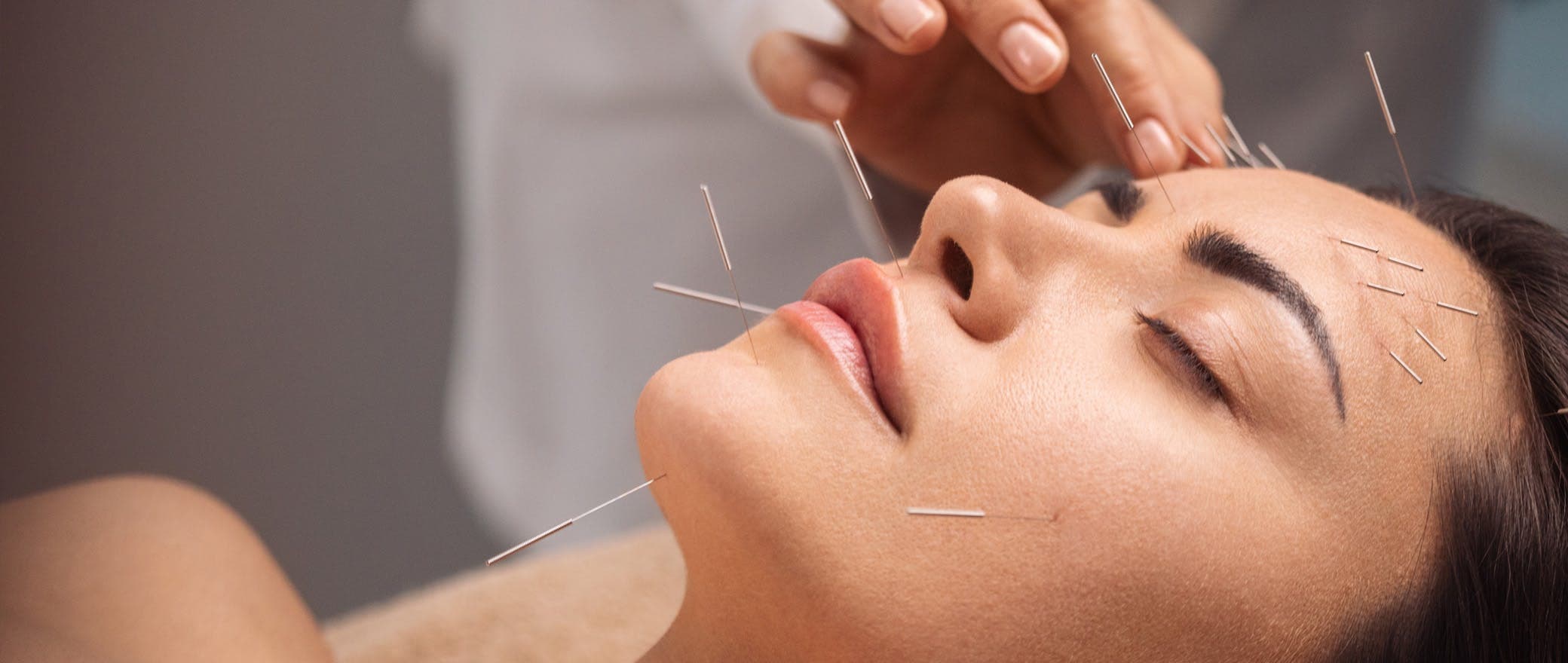 Acupuncture for Anxiety: Does it Work?