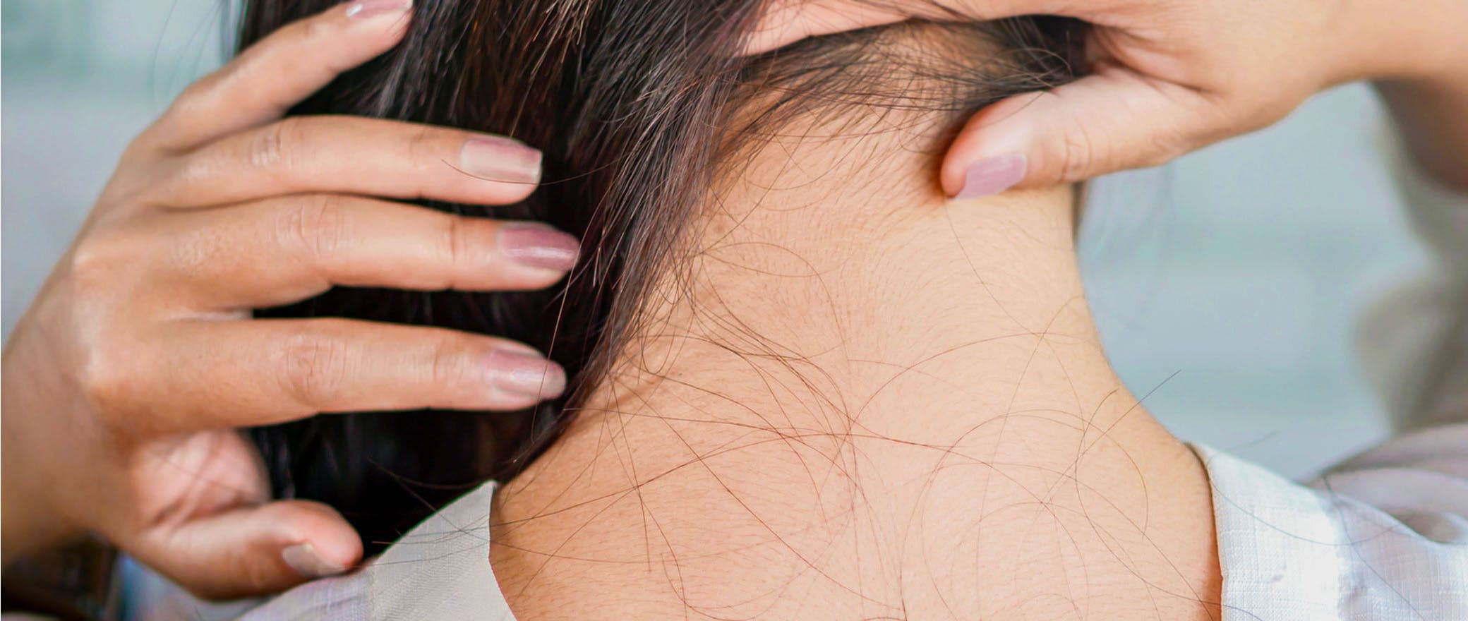The Top Causes of Hair Loss