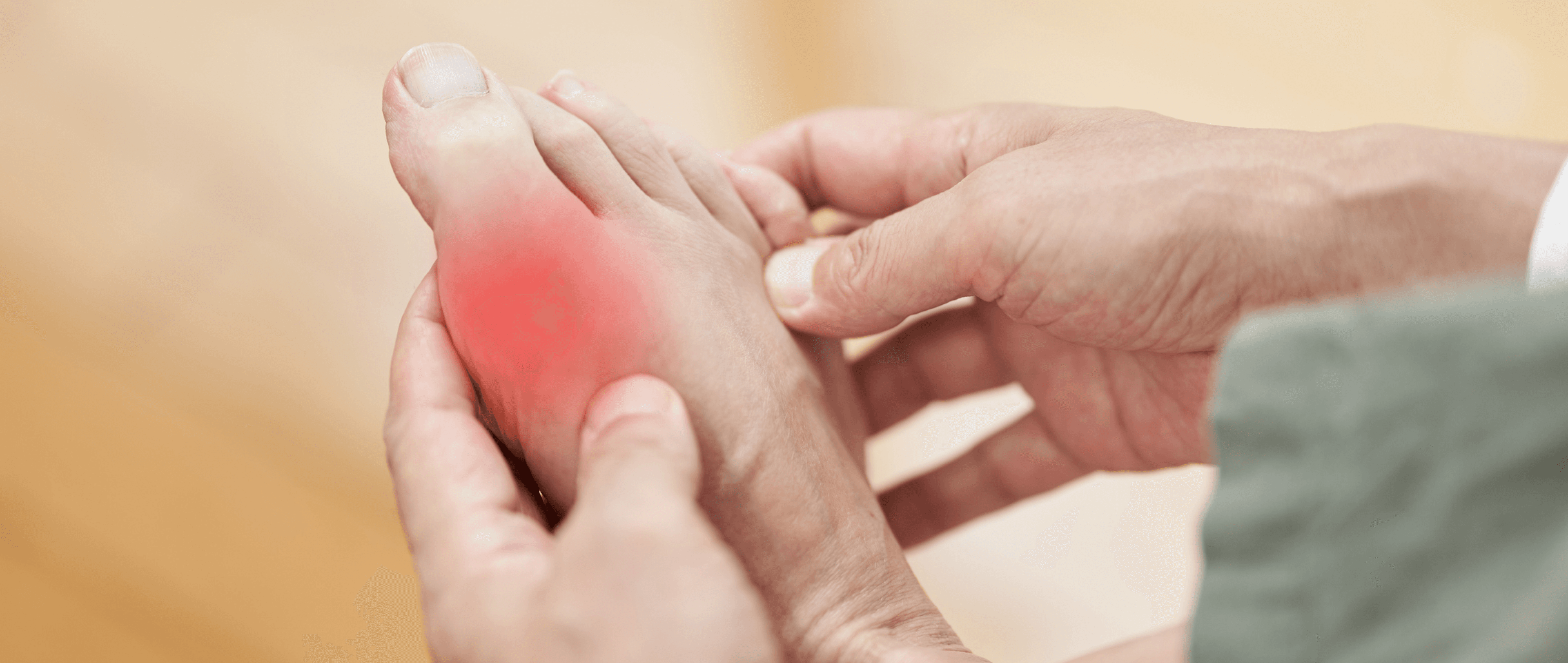 Toe-tally Painful: The Gout Story                        